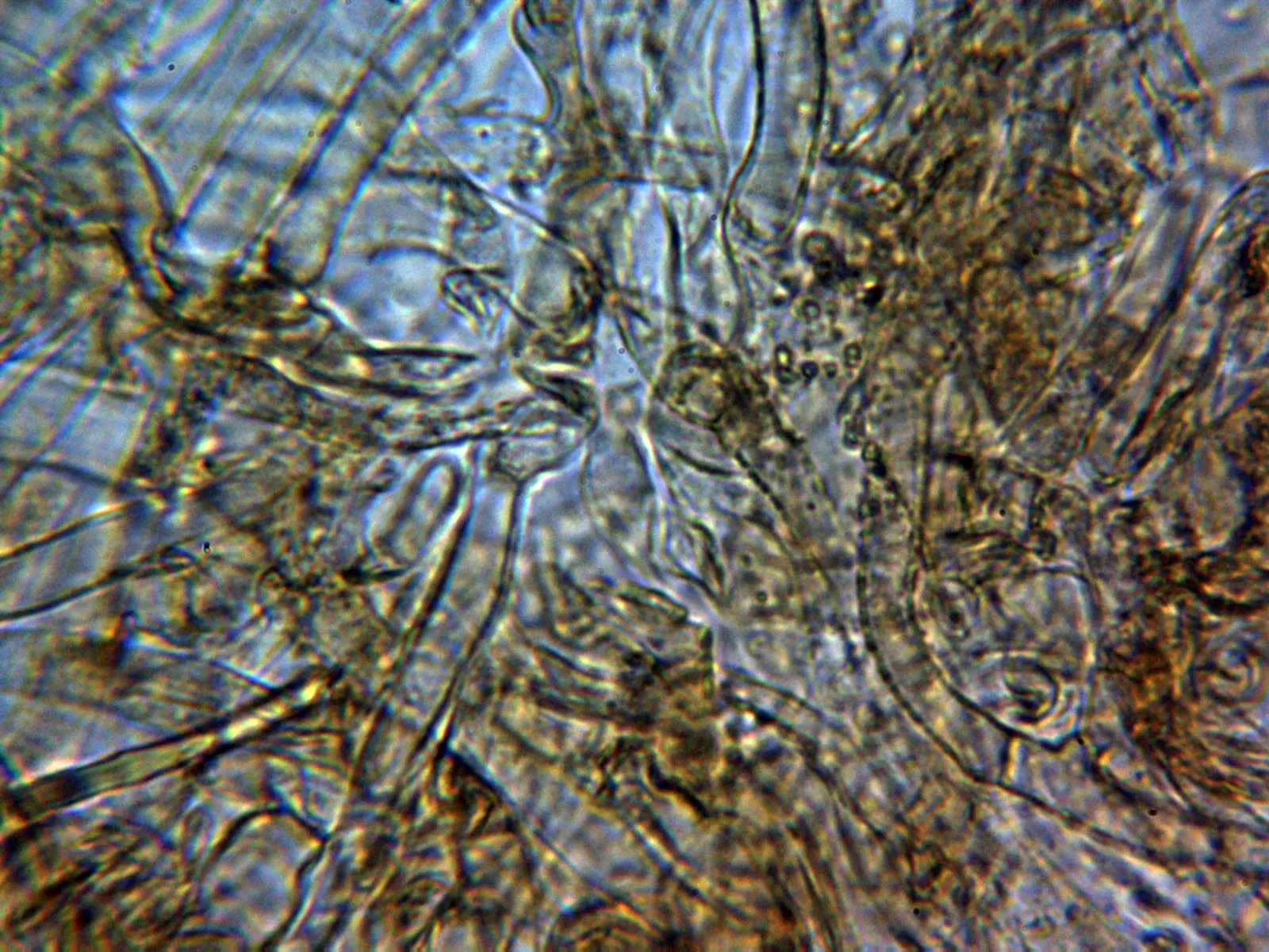 Microscopía de Pholiota lucifera - 10 - Cutícula con pigmento ocráceo